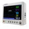 ECG/NIBP Monitor portatile multiparametro per il paziente per la memorizzazione interna dei dati ospedalieri