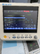 Monitor Mini Ambulance Patient Monitor di Multiparameter di emergenza dell'ospedale
