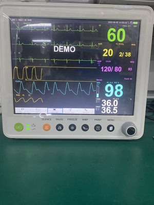 Monitor paziente portatile con i parametri ETCO2 ECG NIBP SPO2 RESP PR TEMPORANEO