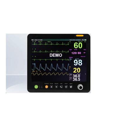 Monitor portatile multiparametrico da 15 pollici apparecchiature di monitoraggio cardiaco per uso medico