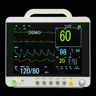 Monitor elettrico neonatale fornito in fabbrica con funzionalità multiparametro per il reparto pediatrico dell'ospedale
