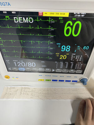 Monitor portatile a bordo letto con ECG SPO2 NIBP TEMP RESP Opzionale ETCO2-Classe II Garanzia di 1 anno